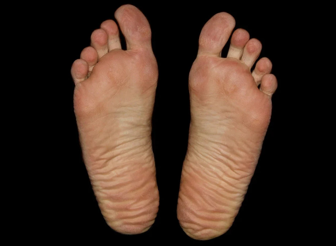 From Heel to Toe: Can Plantar Fasciitis Really Torment Your Toes Too?